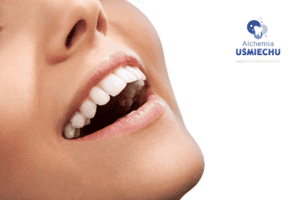 Stomatologia estetyczna-wybielanie zębów