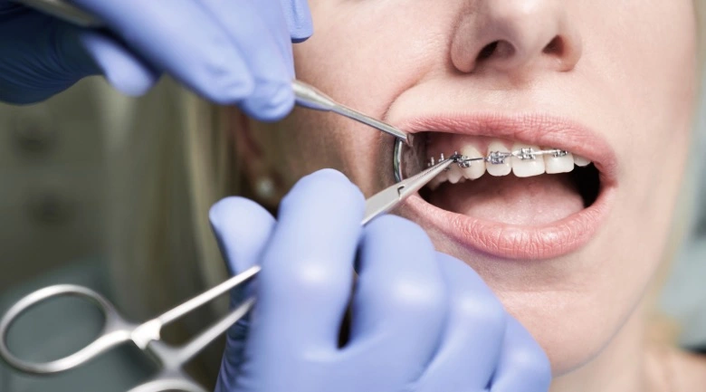 ortodoncja dla dorosłych